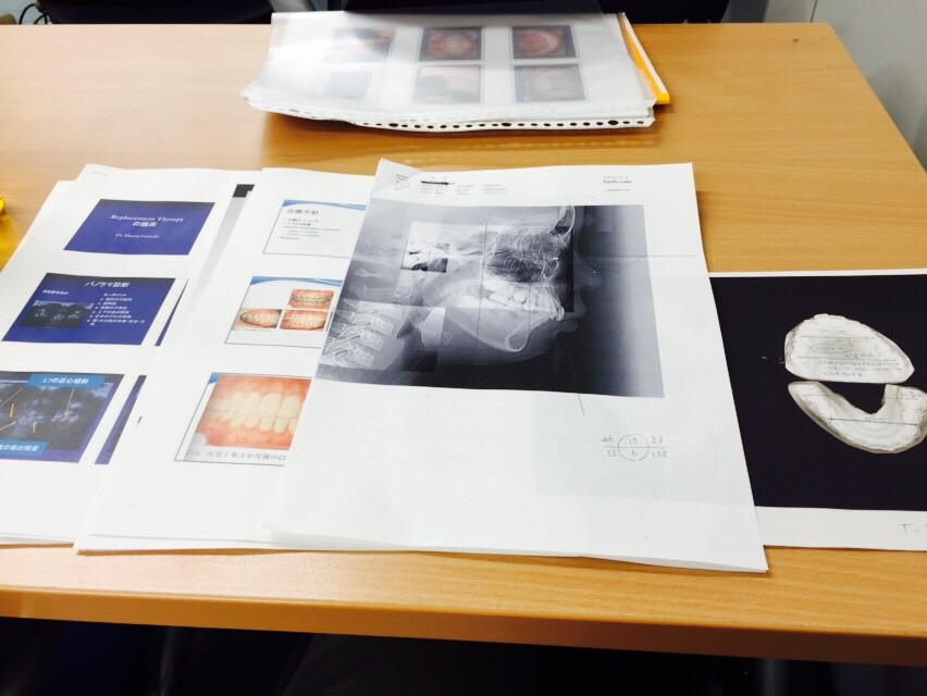 上顎前突（出っ歯）に関するセミナー
