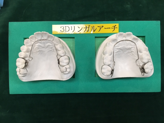 3Dリンガルアーチ