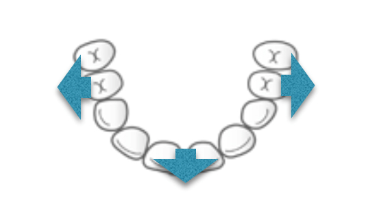 子どもの歯の成長発育