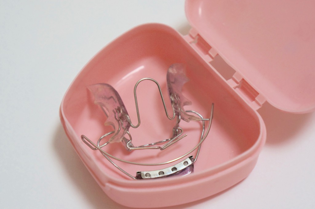 なるべく抜歯をしない矯正